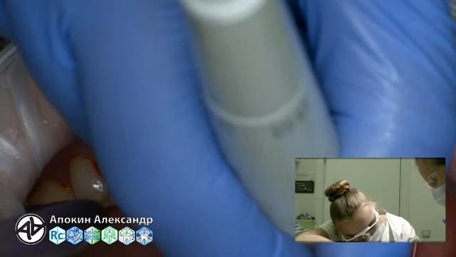 Professional oral hygiene - case 003 Acteon, DTE, Dentsply, Coxo, Floweis, 3M, KerrHawe (livestream смотреть онлайн