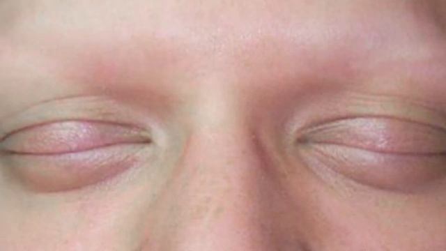 Самые жуткие бьюти процедуры | Хэллоуин 2020 | Интересные факты | топ 20 смотреть онлайн