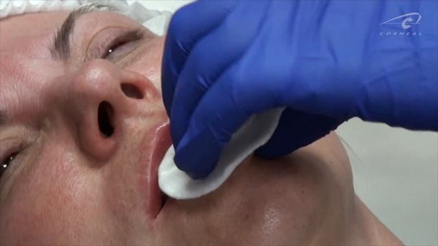Авторская методика. Нижняя губа смотреть онлайн