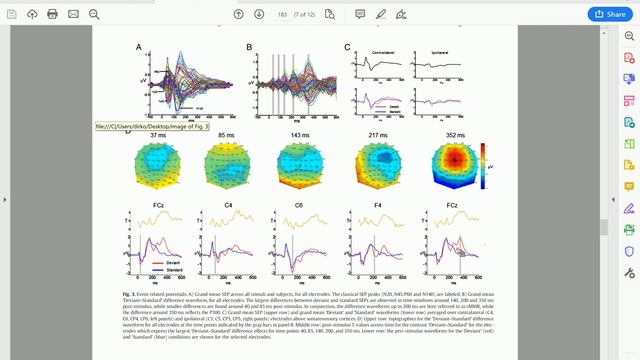 Cognitive event-related potentials II смотреть онлайн