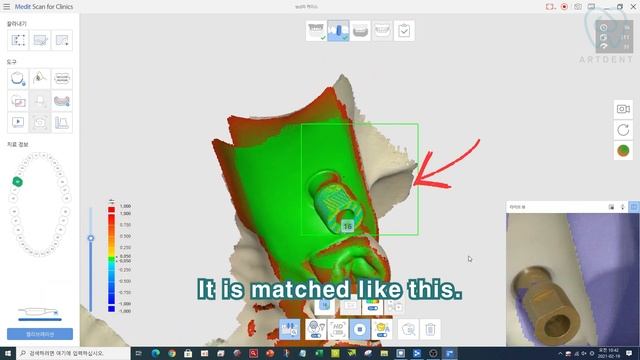 exocad 3.0 version Platform switch/ medit i500,i700 ai scanbody/ artdent смотреть онлайн