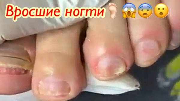 Обработка ногтя??