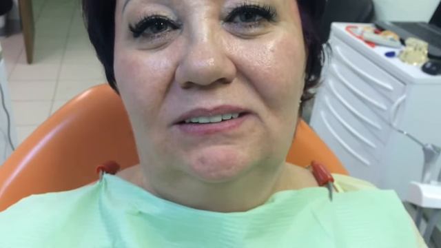 Бюгельный съемный зубной протез. Протезирование верхних зубов металлокерамическими коронками. смотреть онлайн