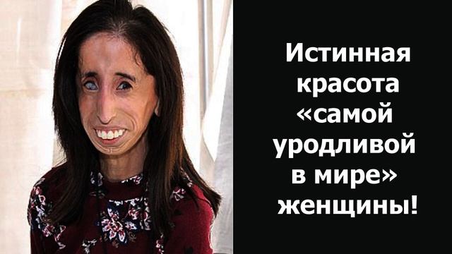 ИСТИННАЯ КРАСОТА «САМОЙ УРОДЛИВОЙ В МИРЕ» ЖЕНЩИНЫ! смотреть онлайн