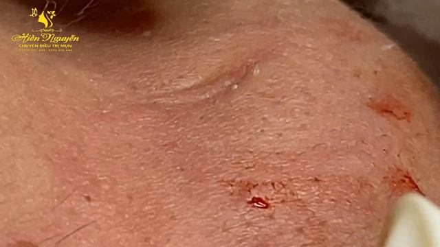 Satisfying Hien Spa Beauty Relaxing Video #27 смотреть онлайн