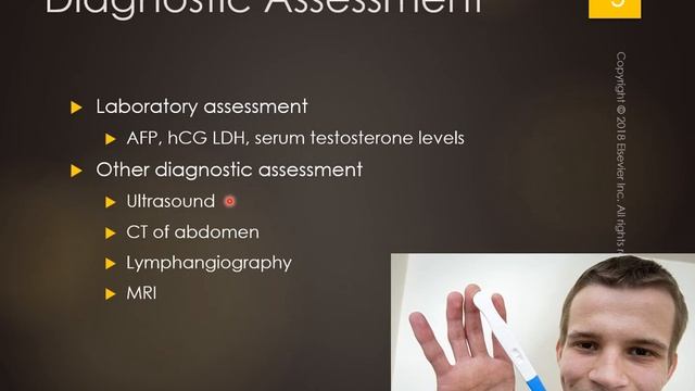 Testicular Cancer смотреть онлайн