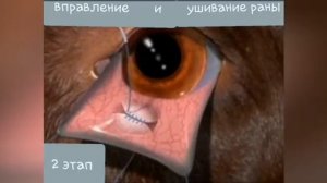 хирургическое лечение пролапса железы третьего века.mp4