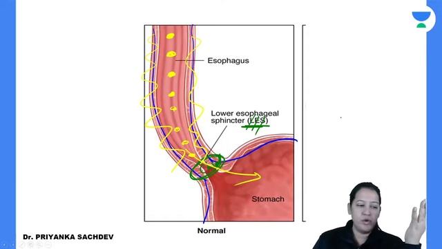 GIT | Superfast Course-Pathology | Unacademy Future Doctors | Dr.Priyanka смотреть онлайн