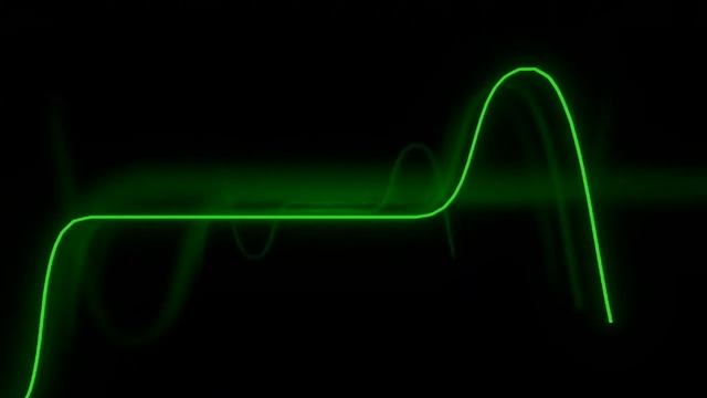 Восстановление шаровой опоры треугольного рычага Chevrolet Cruze смотреть онлайн