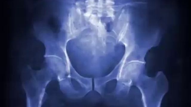 Blitz The League - Injury Concepts смотреть онлайн