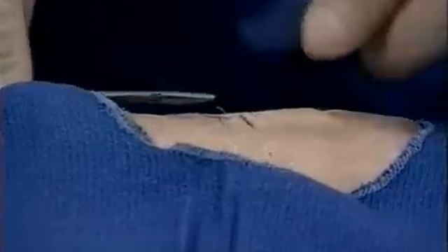 Техника хирургического шва Suture Technique смотреть онлайн