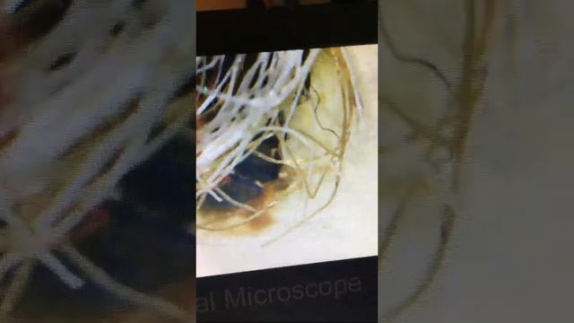 Часть №1.Сине-зеленый жук с крыльями обнаружен в доме. Моргеллоны? смотреть онлайн