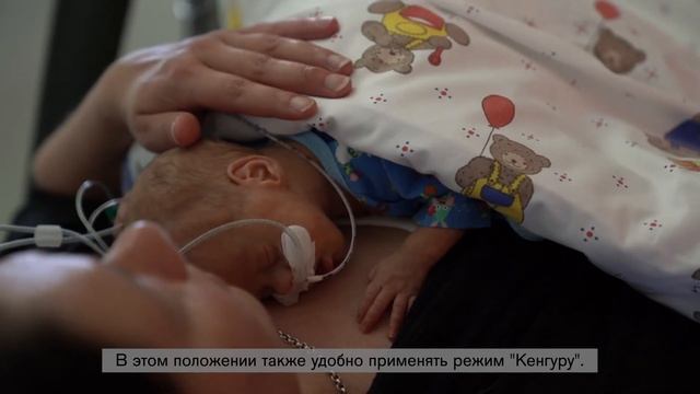 Случай из практики: выхаживание новорожденных в ОРИТН с инкубатором-трансформером Babyleo TN500 смотреть онлайн