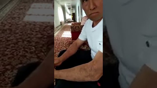 Бессонница и сильнейший зуд кожного покрова смотреть онлайн