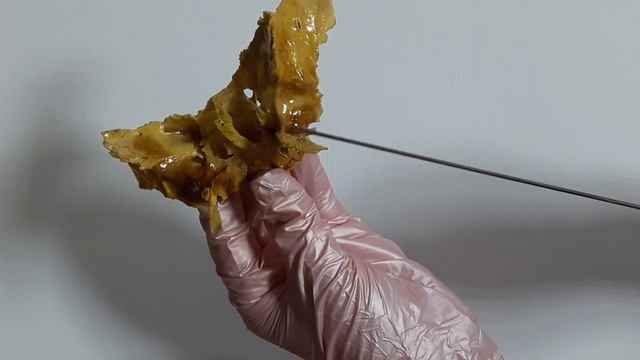 Кости мозгового черепа: лобная, теменная, затылочная и клиновидная смотреть онлайн