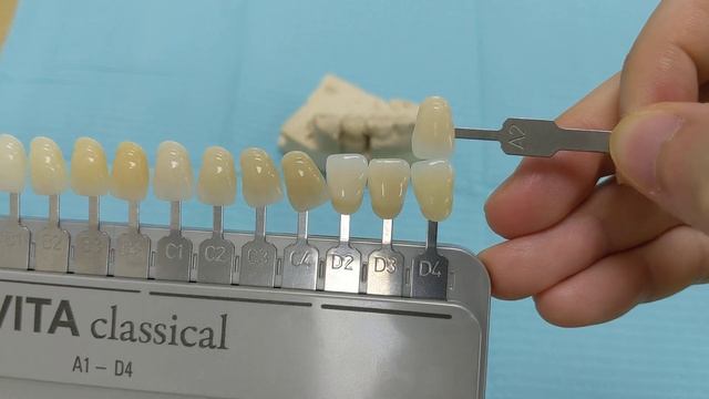 What A2 tooth color looks like смотреть онлайн