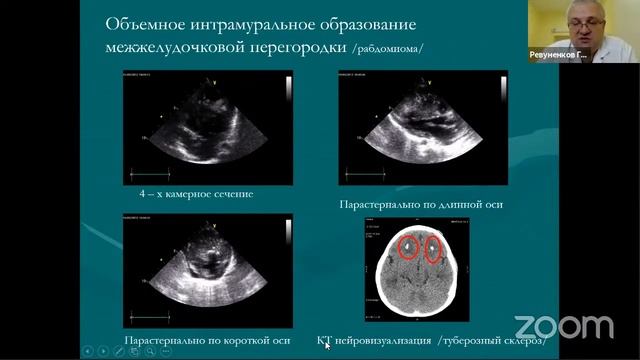 Современные методы лучевой диагностики в детской кардиологии смотреть онлайн