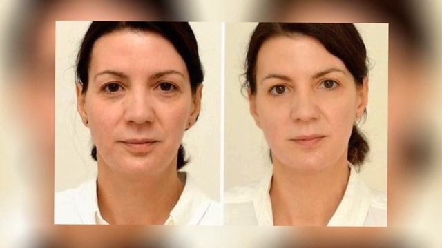 ЭТА ЖЕНЩИНА ПИЛА 3 ЛИТРА ВОДЫ В ДЕНЬ В ТЕЧЕНИЕ 4 НЕДЕЛЬ. И ВОТ ЧТО ИЗ ЭТОГО ВЫШЛО! смотреть онлайн