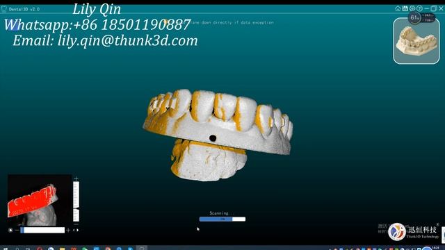 Denture Model Scanned by Thunk3D Dental Lab Scanner смотреть онлайн
