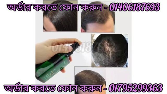 ##Disaar Hair Care Nutrient Solution Promotes hair Growth,review,price,how to use## смотреть онлайн