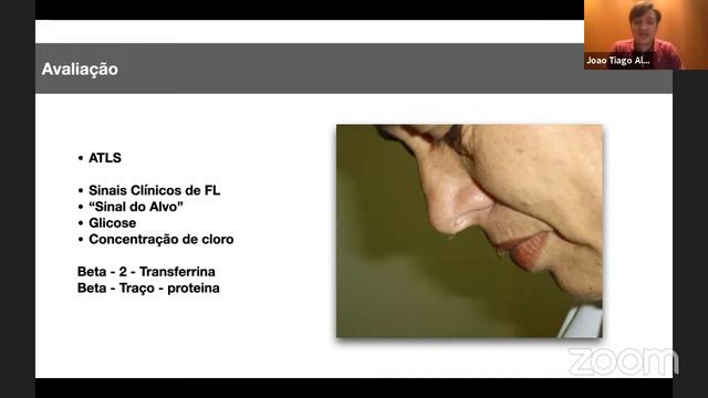 Aspectos técnicos do tratamento cirúrgico das fístulas liquóricas traumáticas смотреть онлайн