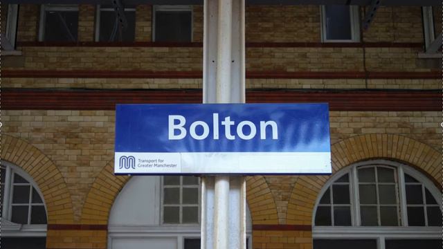 Bolton Discrepancy in Clear Aligners, Invis, Straightwire смотреть онлайн