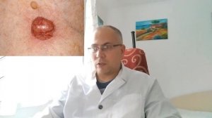 Базалиома - видео о базальноклеточном раке кожи