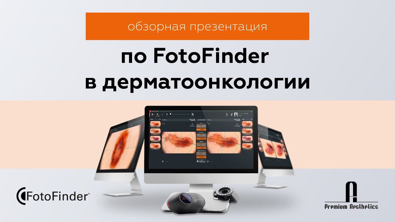 Обзорная презентация по FotoFinder в дерматоонкологии