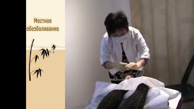Иглоукалывание в лечении пяточной шпоры смотреть онлайн