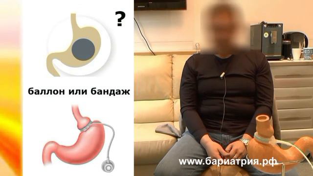 Внутрижелудочный баллон или бандажирование желудка