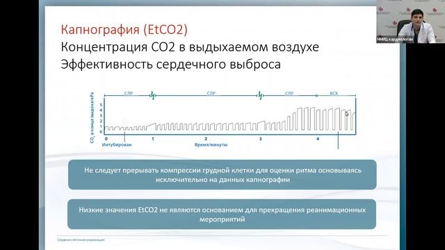 Расширенная сердечно легочная реанимация Аветисян Э.А. смотреть онлайн