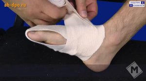 Наложение возвращающейся повязки на дистальный отдел стопы