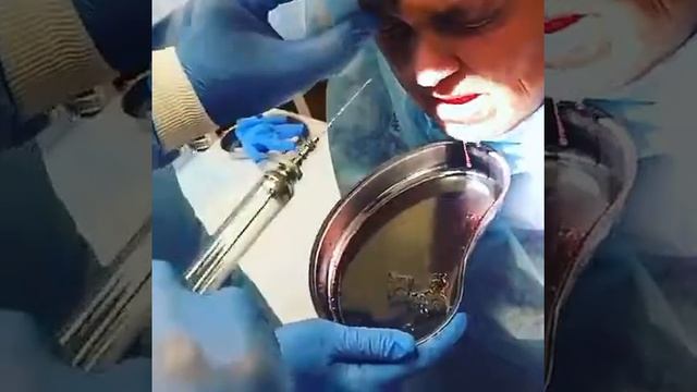 Узаиров Тимур Магомедшапиевич. Лор-врач. смотреть онлайн