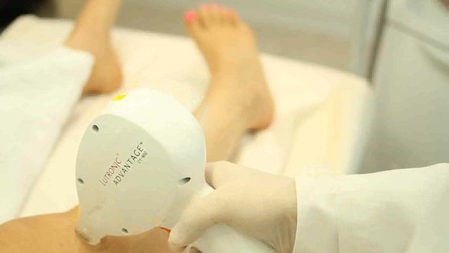 Аппарат Advantage, лазерная эпиляция смотреть онлайн