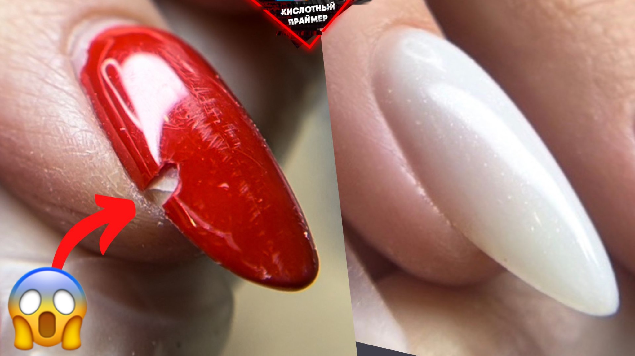 СНОВА ЖЕСТКИЕ ТРЕЩИНЫ до МЯСА! НАРАЩИВАНИЕ НОГТЕЙ ГЕЛЕМ! смотреть онлайн