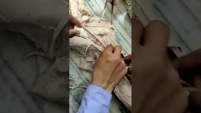 Arteries of forelimb of ox. veterinary Anatomy. смотреть онлайн