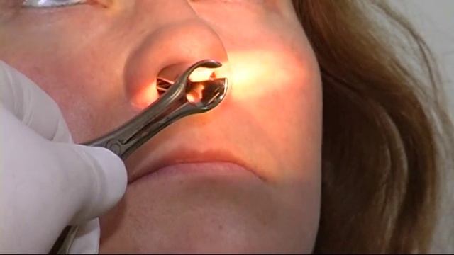 Поликлиника "Эввива" смотреть онлайн