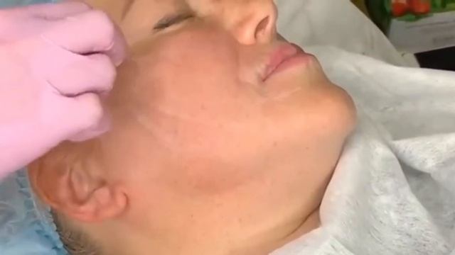 НИТИ COG УСТАНОВКА !