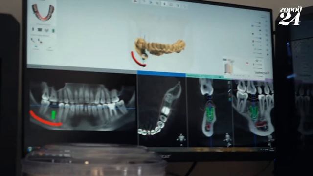 SapaDent - о стоматологии город 24 Астана смотреть онлайн