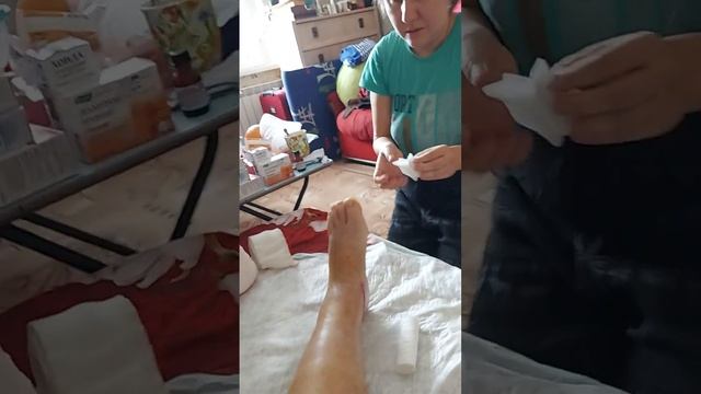 Перевязка после снятия швов ...#красота #образование #весна смотреть онлайн