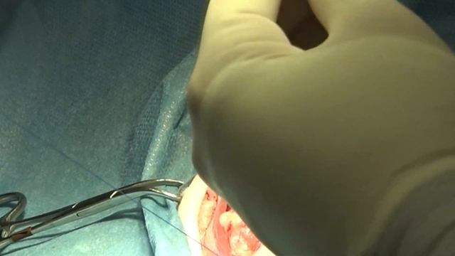 Active Drain Placement