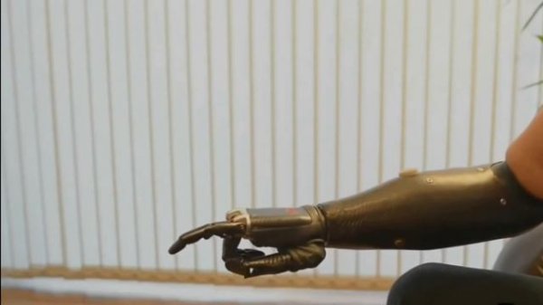 Бионический протез руки/Bionic prosthetic hand