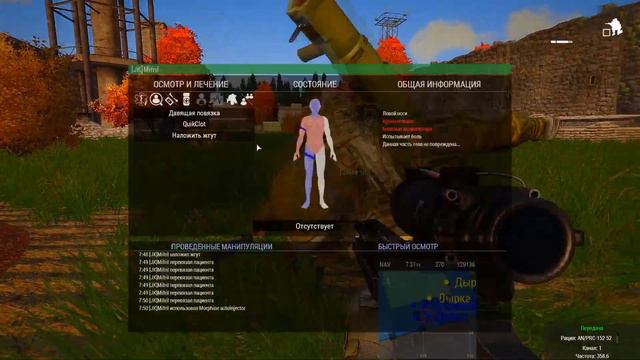 время лечения смотреть онлайн