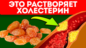 Что едят старые врачи для понижения холестерина!? Продукты от холестериновых бляшек
