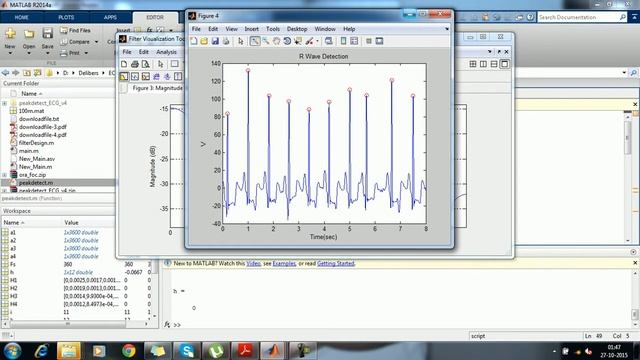 R wave detection using fractional digital смотреть онлайн