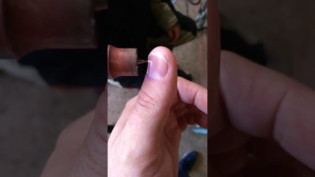 Холодная плазма. Стимулирует рост ногтя. смотреть онлайн