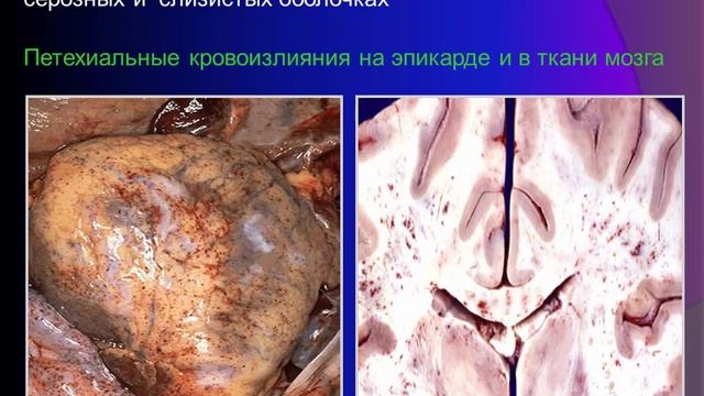 13:50 Нарушения гемодинамики смотреть онлайн