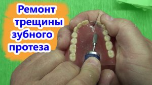 Ремонт трещины съёмного зубного протеза.mp4