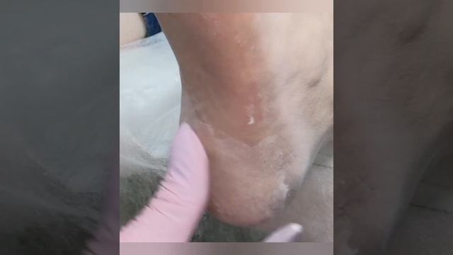 Аппаратный педикюр смотреть онлайн