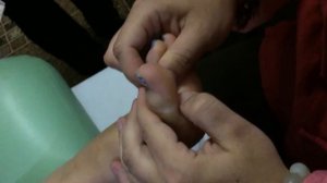 Китайский массаж стоп.